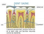 dent saine - 
